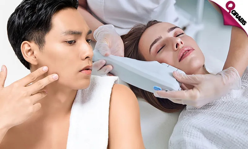 Morpheus Skin Tightening Treatment for Face & Neck!